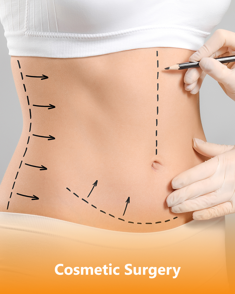 Cosmetic Surgery