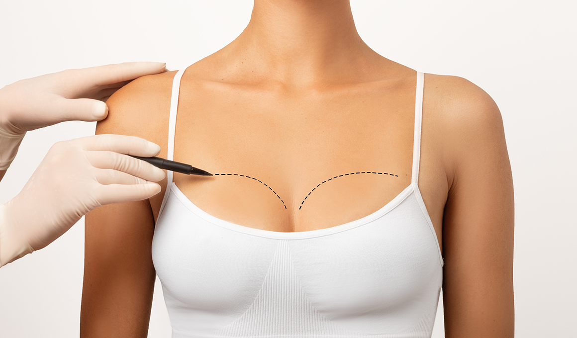 Breast-Reconstruction