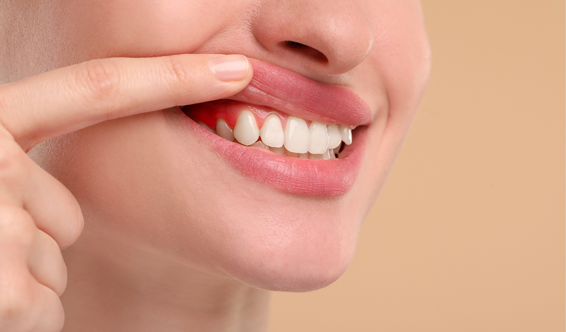 Gum-Care-&-Periodontics