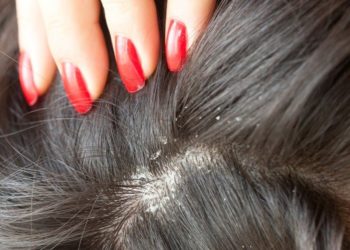 Seborrheic Dermatitis & Dandruff Treatment in mumbai, india