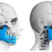 Orthognathic Jaw Surgery in mumbai, india