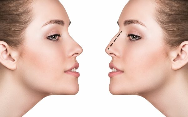 Everything You Should Know About Septoplasty Surgery in mumbai india