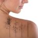 Things You Should Know About Tattoo Removal in mumbai india
