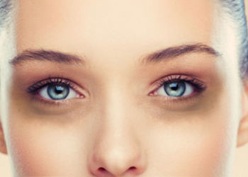 5 reasons to go for treatment for dark circles in mumbai india