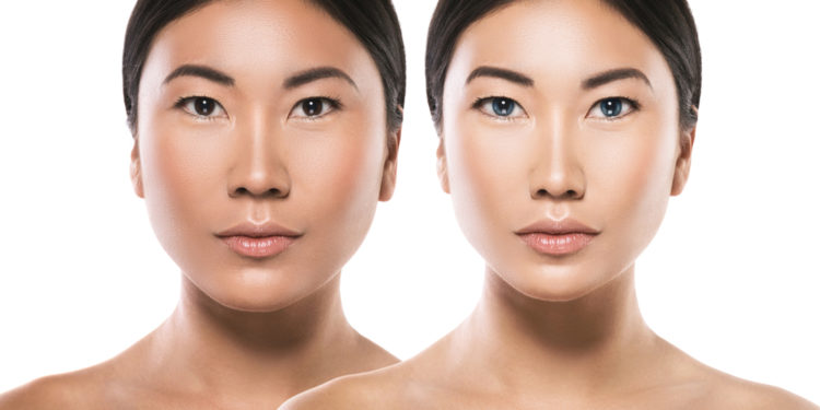 Jaw Correction Surgery - The Best Solution for Many Facial Irregularities