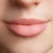 Lip Surgery In India – Why You Should Consider It