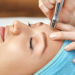 Latest advancement in microdermabrasion treatment in India