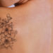 Permanent tattoo removal in mumbai process in brief