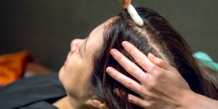 Regrow hair follicles - Acquire stem cell hair transplant India