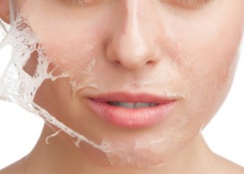 Skin Peeling Treatment - Improve the Appearance of the Skin