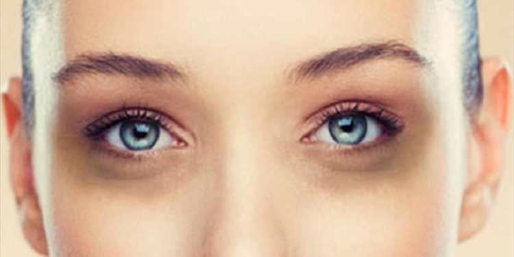 Get Rid Of Those Panda Eyes With Proven Dark Circle Removal Treatments In Mumbai