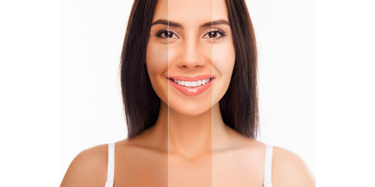 Skin Whitening Procedures at Clinics