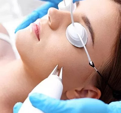 Fractional CO2 Laser Treatment Side Effects