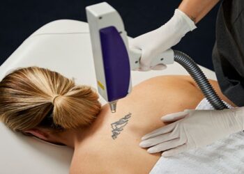 Risks And Benefits Of Tattoo Removal Treatment