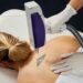 Risks And Benefits Of Tattoo Removal Treatment