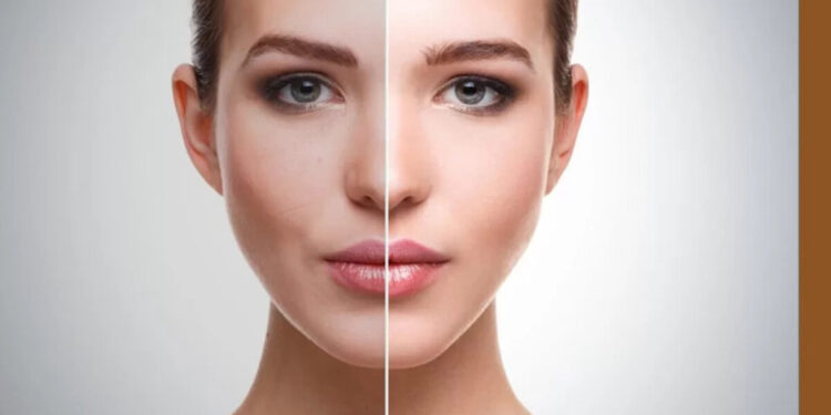 Skin Whitening Treatment, Procedures, Cost, And Side Effects