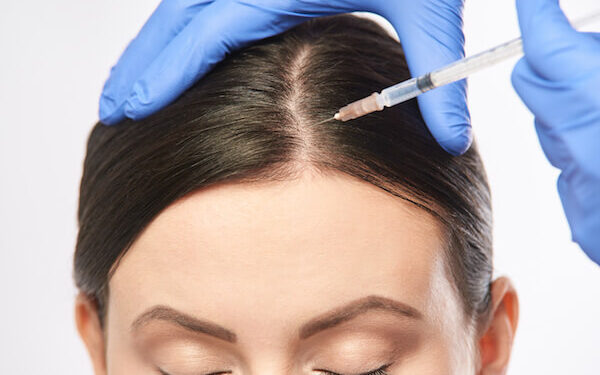 Platelet-Rich Plasma (PRP) What it is And its Application