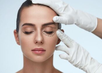 5 Reasons You Should Consider Eyelid Surgery