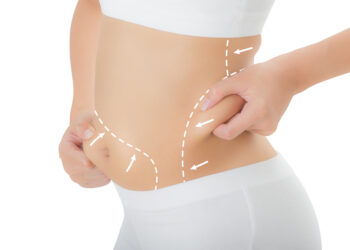 Is Liposuction Surgery Risky?