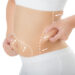 Is Liposuction Surgery Risky?