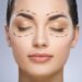 Ptosis Surgery Treatment and Management