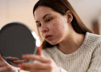 Skin Pigmentation Treatment