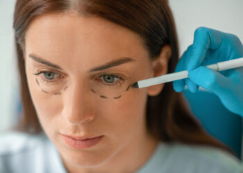 droopy eyelid surgery