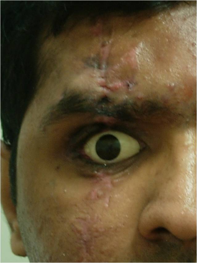 Picture6