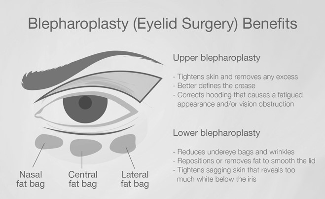Best Blepharoplasty Surgery in Mumbai, eyelid Treatment at Affordable Price Cost India by Dr Debraj Shome at The Esthetic Clinics Best Blepharoplasty Surgery in Mumbai, eyelid Treatment at Affordable Price Cost India by Dr Debraj Shome at The Esthetic Clinics