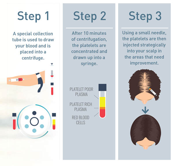 Best PRP Hair Treatment in Mumbai, Hair Growth at Affordable Price Cost India by Dr Debraj Shome at The Esthetic Clinics Best PRP Hair Treatment in Mumbai, Hair Growth at Affordable Price Cost India by Dr Debraj Shome at The Esthetic Clinics