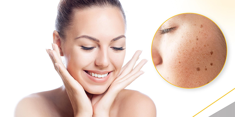 Best Face Skin Pigmentation Treatment in Mumbai at Affordable Price Cost India by Dr Rinky Kapoor at The Esthetic Clinics