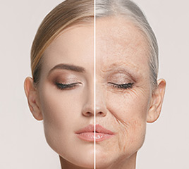 Facelift-img