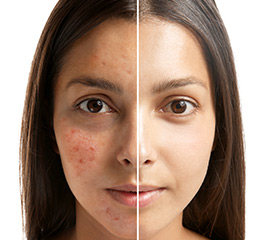 Face Scar