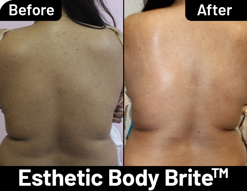 Esthetic Body Brite