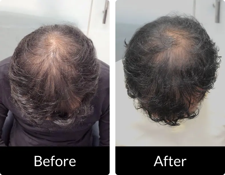 Client-image-8-5