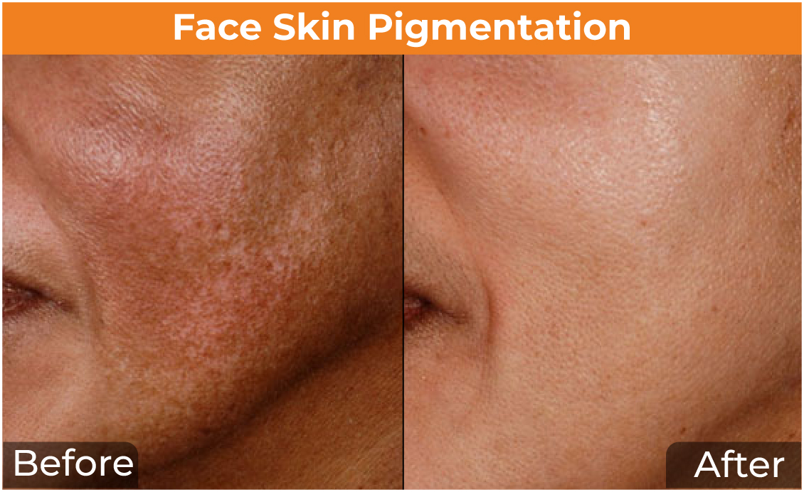 Face-Skin-3