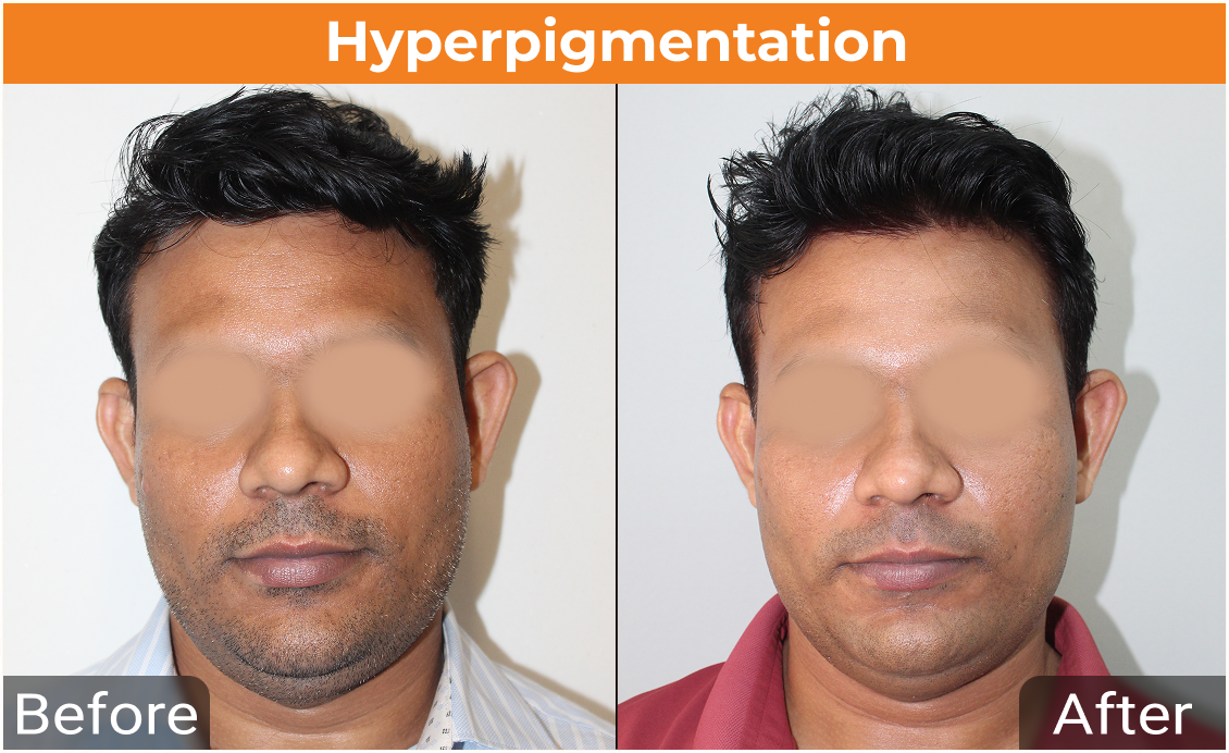 before_after_1