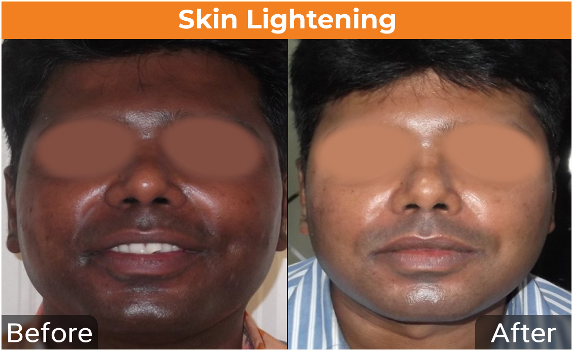 before_after_217
